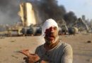 Monumental blasts leave Beirut in ruins, scores dead, 300,000 homeless